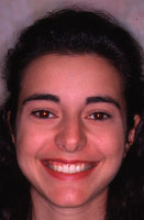 lr1-1.jpg (6282 bytes)